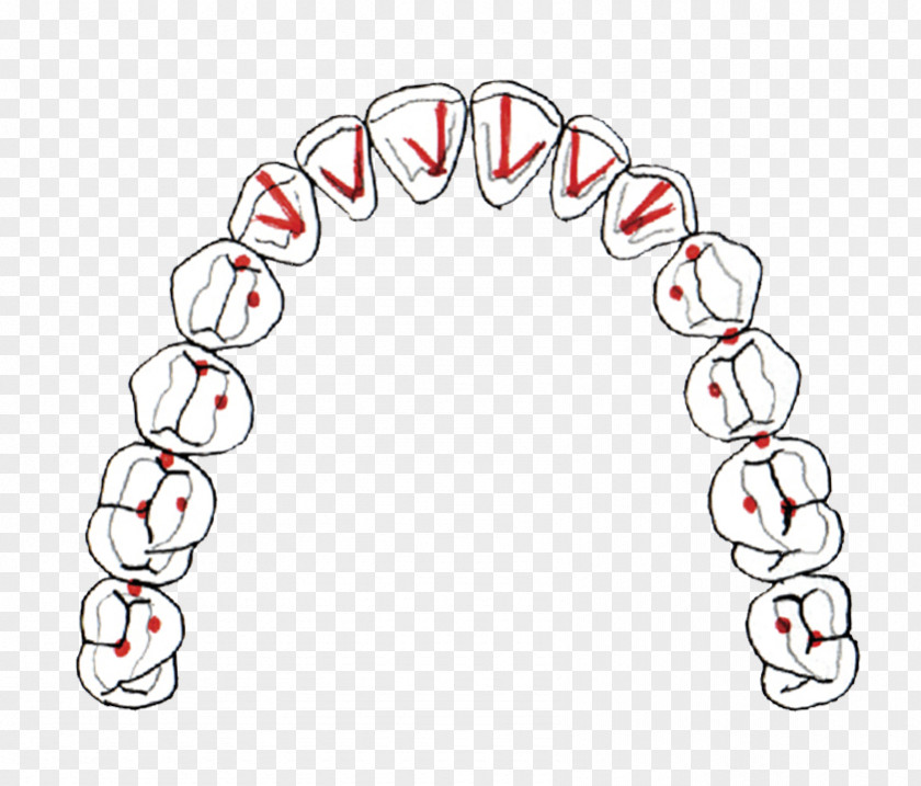 Occlusion Dentistry Dental Midline Centric Relation Braces PNG