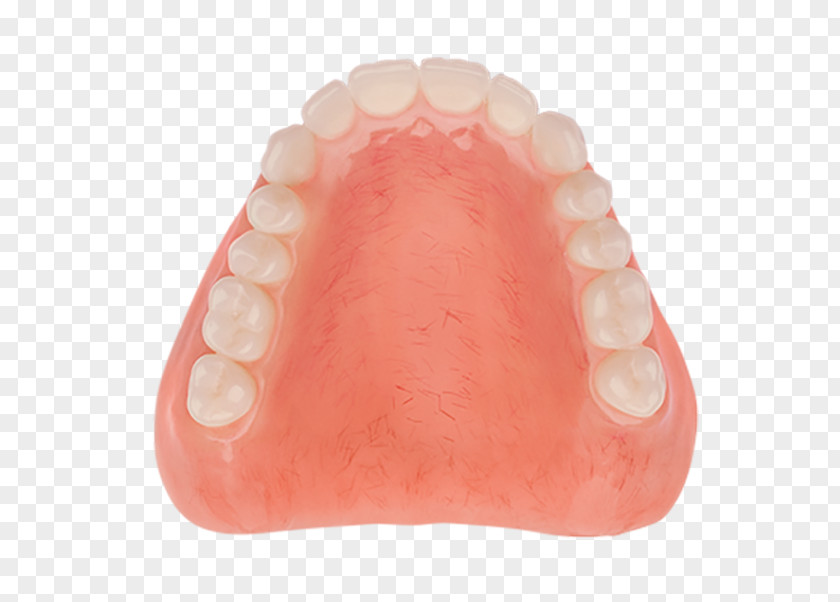 Aspen Dental Dentures Tooth Dentistry Acrylic Resin Poly PNG