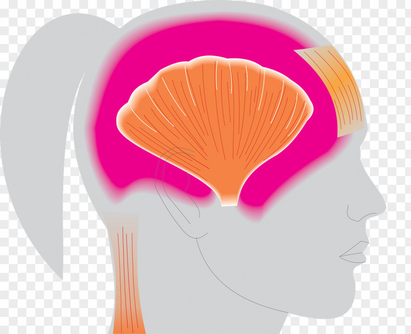 Health Migraine Headache Symptom Therapy PNG