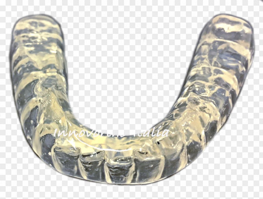 Occlusal Splint Bruxism Temporomandibular Joint Jaw Orthodontics PNG