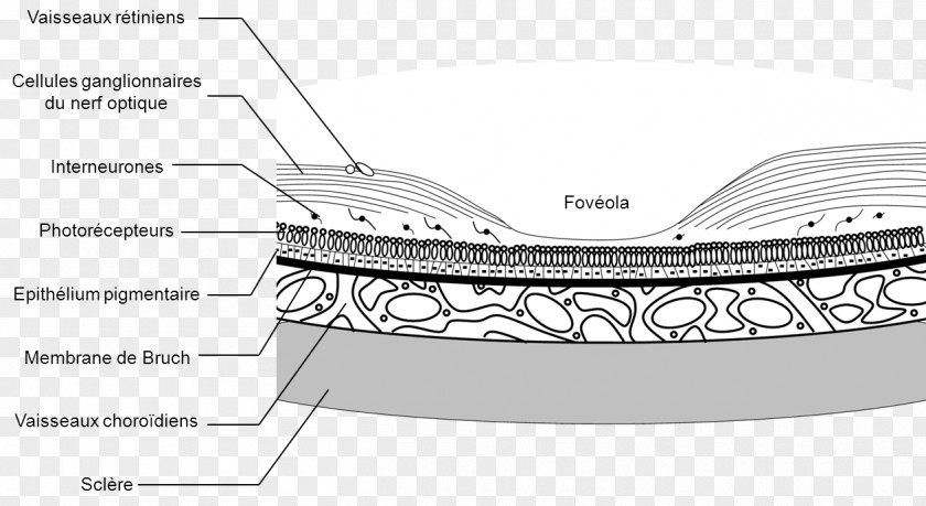 Eye Choroid Uveal Melanoma Retina Human PNG