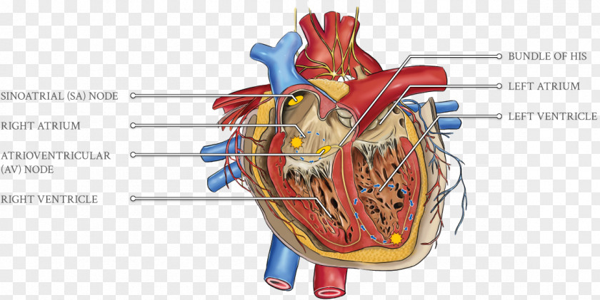 Ecg Ventricular Tachycardia Cardiology Heart Hypercholesterolemia Cardiovascular Disease Cardiac Monitoring PNG