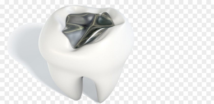Decayed Tooth Amalgam Silver Dentistry Metal PNG