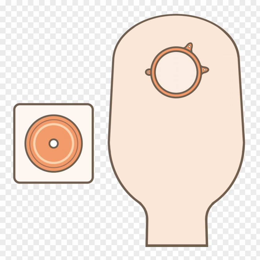 Stoma Ostomy Pouching System Orthotics Health Care PNG pouching system , anus clipart PNG