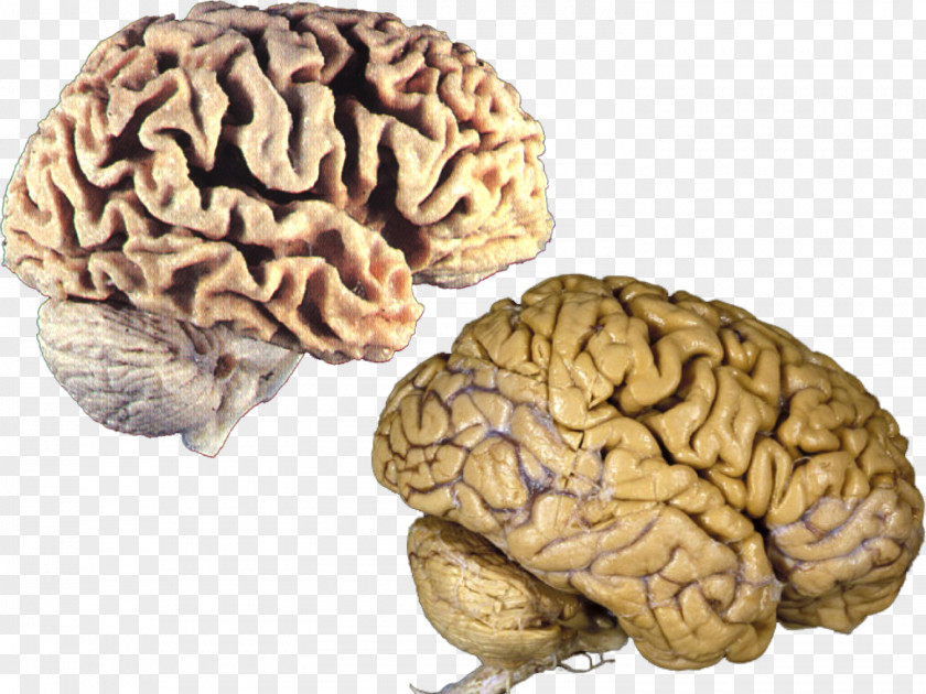 Flash Cards Right Brain Human Size Anatomy PNG