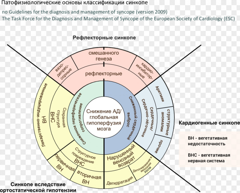 Brain Syncope Orthostatic Hypotension Carotid Sinus Heart PNG