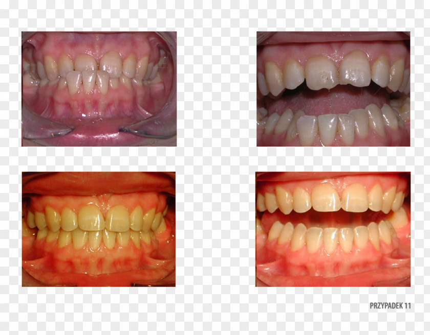 Tooth Dentistry Therapy Orthodontics Clinic PNG