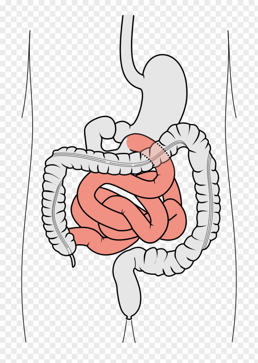 Liver Gastrointestinal Tract Large Intestine Small Duodenum Leaky Gut Syndrome PNG