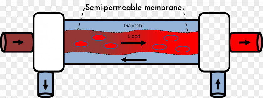 Hemodialysis Transmembrane Protein Pressure PNG