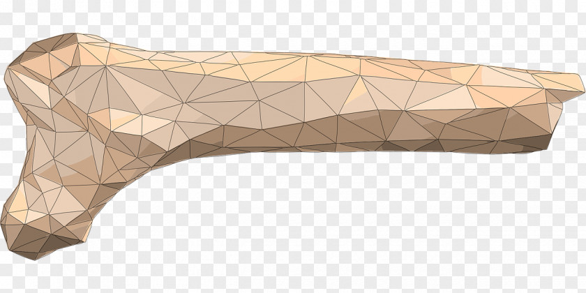 Osteoporosis Bone Fracture Polygon Rising Star Cave PNG