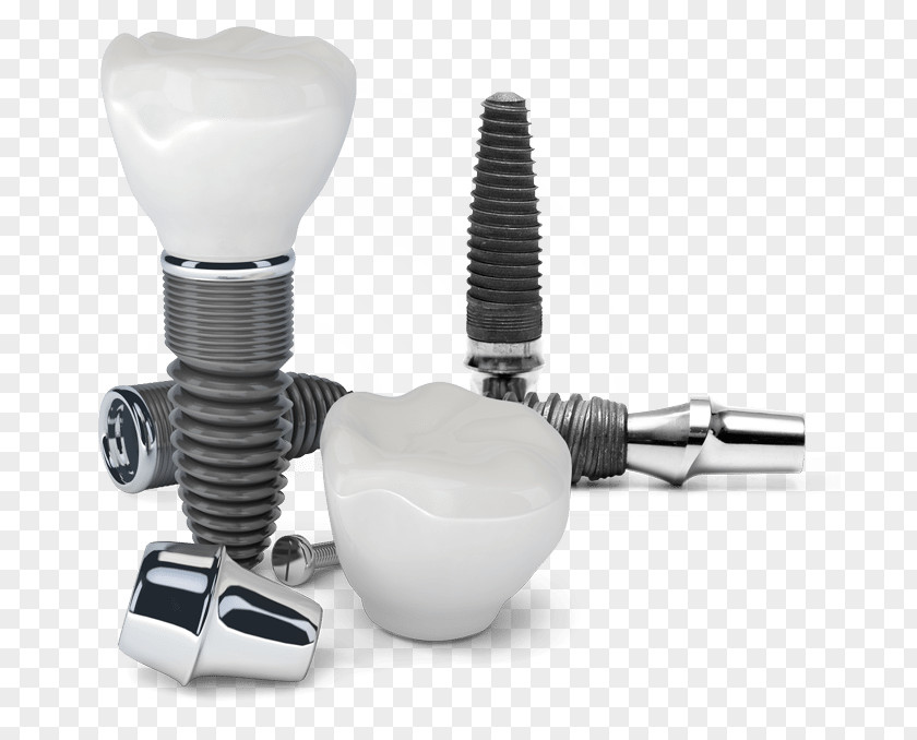 Dentistry Dental Implant Cosmetic PNG