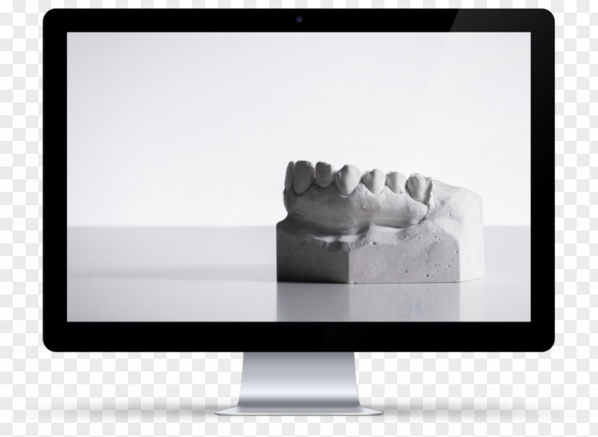 Muckup Computer Monitors IMac Cosmetic Dentistry Veneer Tooth Whitening PNG