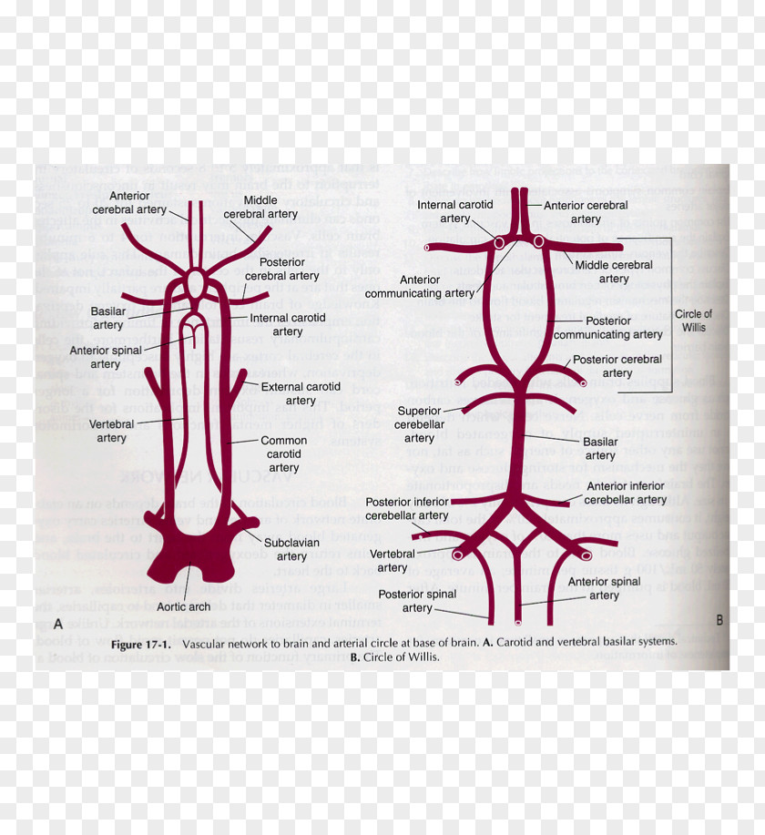 Vertebral Posterior Spinal Artery Anterior Inferior Cerebellar PNG