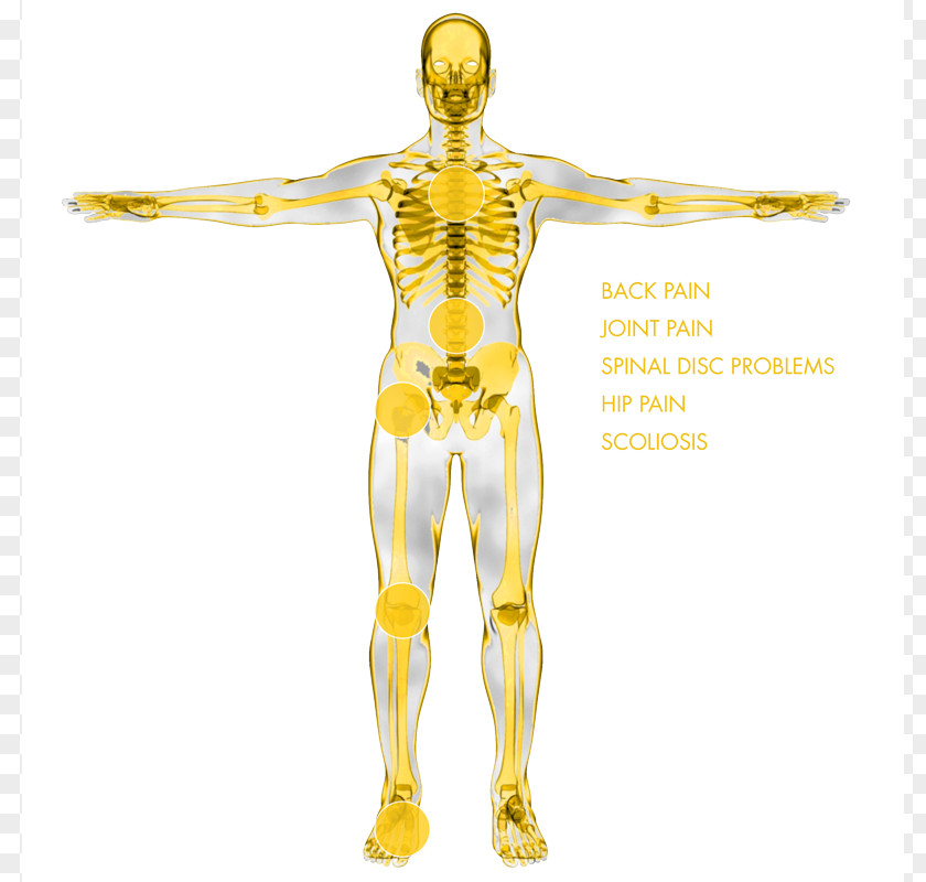 Backpain Muskuläre Dysbalance Shoulder Nerve Muscle Muscular System PNG