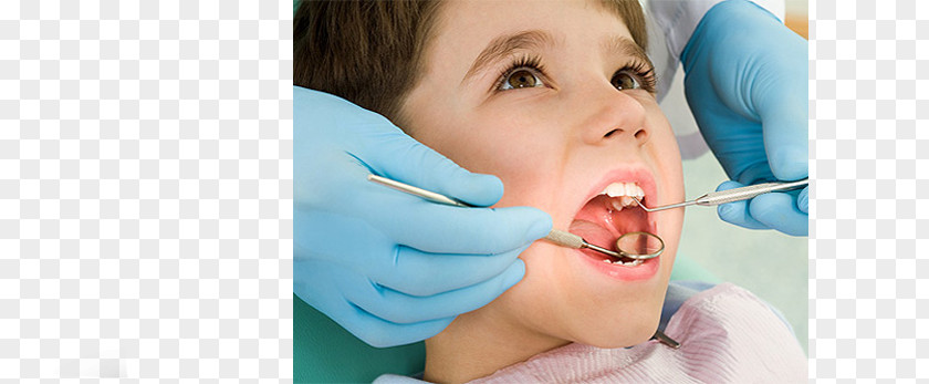 Dentist Clinic Pediatric Dentistry Cosmetic Dental Implant PNG