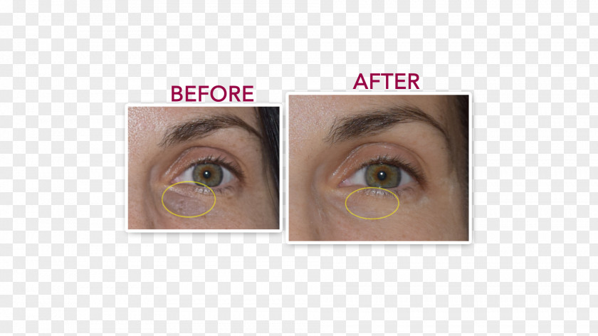 Eye Eyelash Extensions Shadow Liner Lip PNG