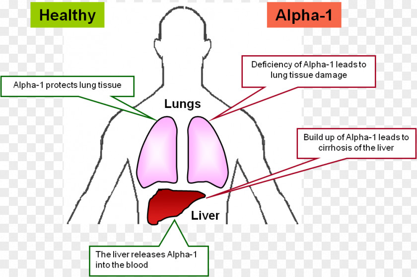 Health Chronic Obstructive Pulmonary Disease Lung Finger PNG