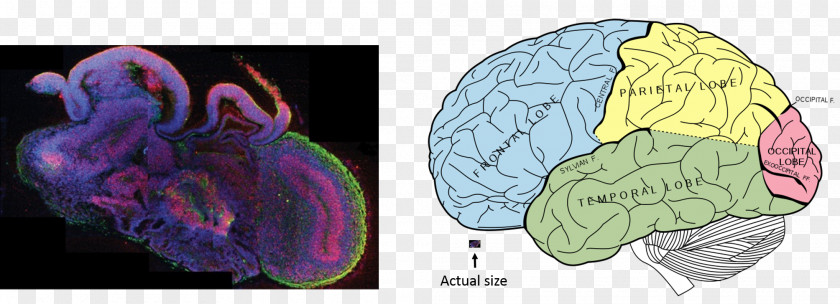 Brain Lobes Of The Frontal Lobe Human Parietal PNG
