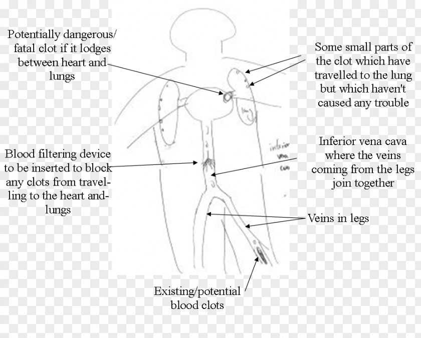 Angle Drawing Product Design Diagram Point PNG