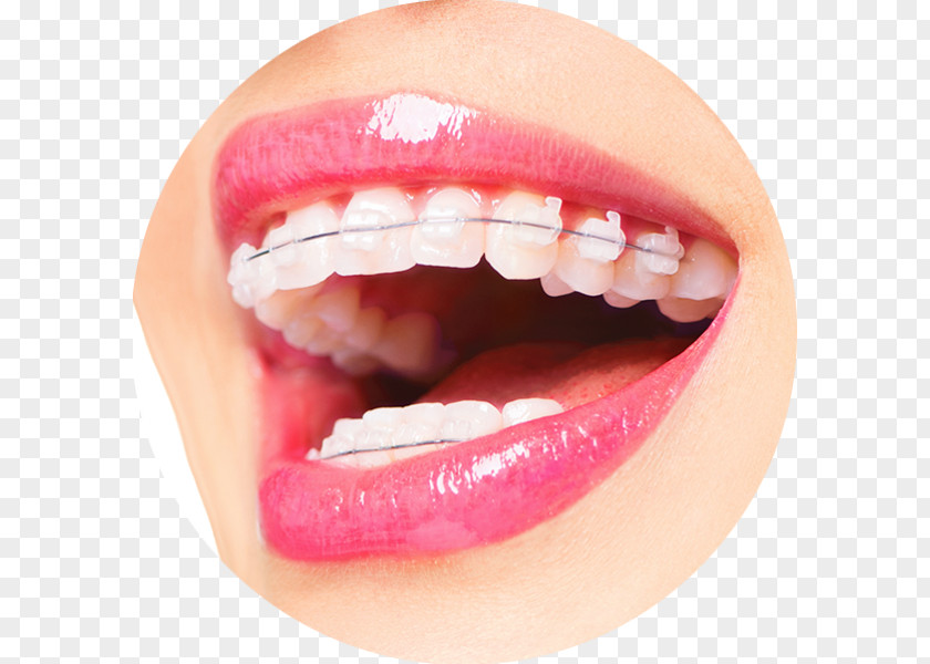 Byfleet Dental Boutique Orthodontics Dentistry Braces PNG
