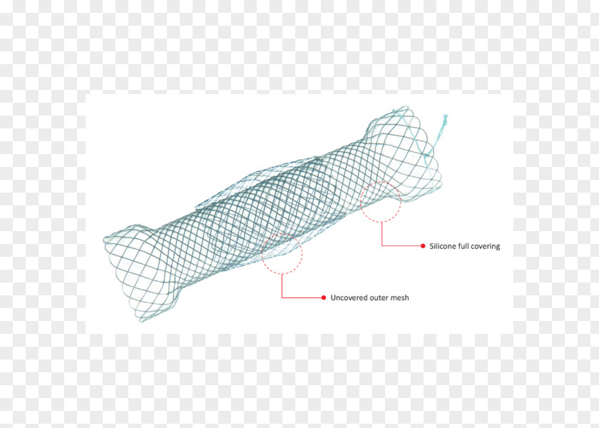 Taewoong Medical Co Ltd Stenting Esophageal Varices Esophagus PNG