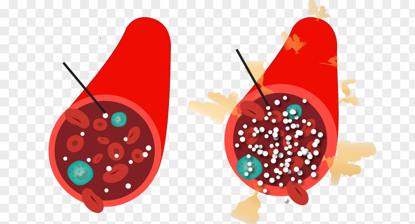 Blood Sugar Hyperglycemia Diabetes Mellitus Type 2 Glucose Monitoring PNG