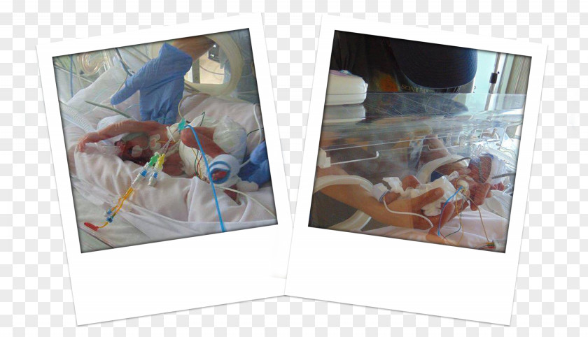 Incubator Queen Elizabeth University Hospital Neonatal Intensive Care Unit Infant Birth Plastic PNG