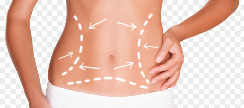 Body Contouring Abdomen Adipose Tissue Cryolipolysis Abdominoplasty PNG