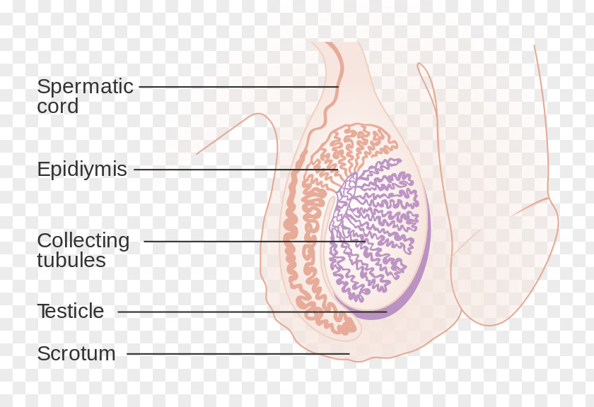Man Undescended Testicle Spermatic Cord Hydrocele Testicular Cancer PNG