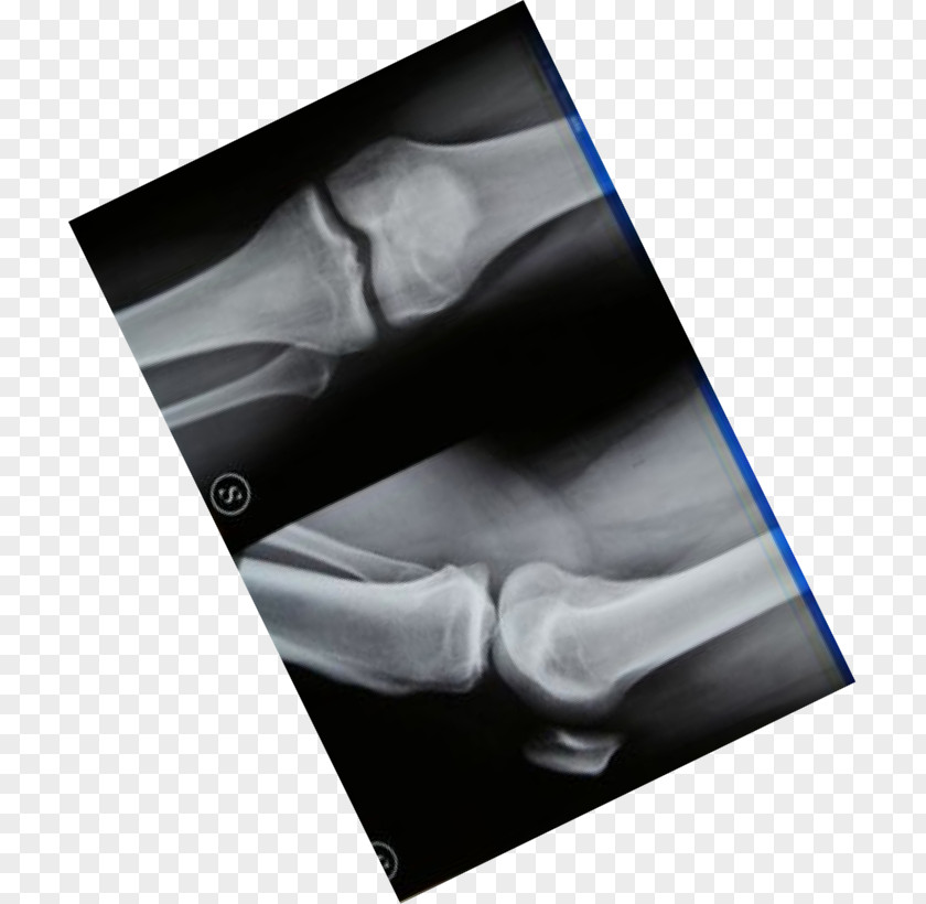 DI Miami Beach Osteopathy Tuxedo Sweater Knee PNG