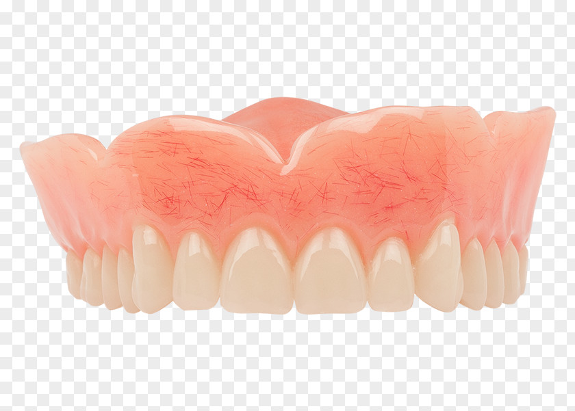 Tooth Dentures Dentistry Dental Implant PNG