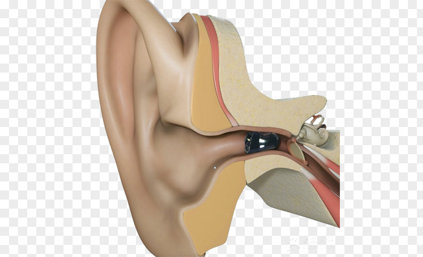 Ears Small Hearing Aids Aid Starkey Laboratories Ear Canal PNG