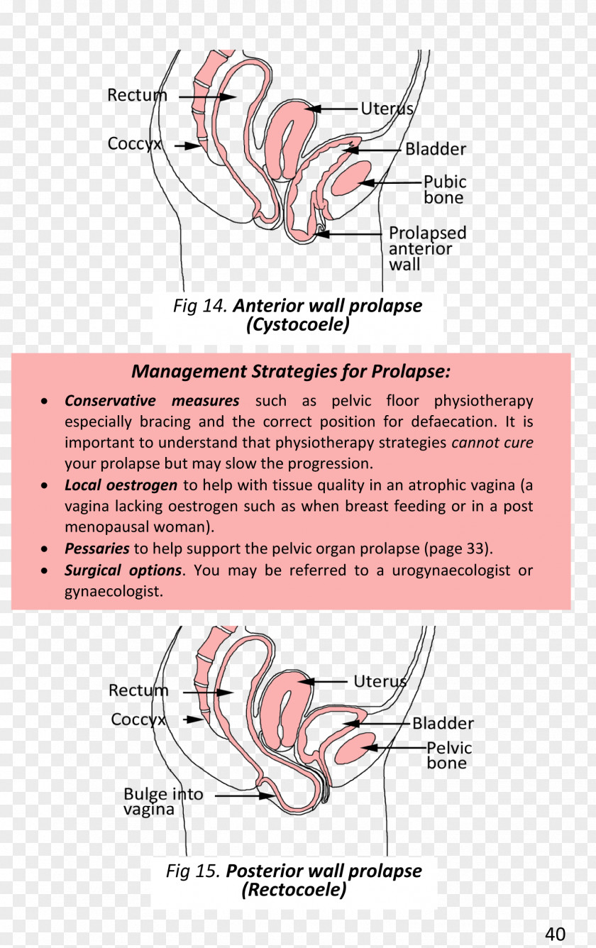 Book Surgery Pelvic Floor Gynaecology Physical Therapy PNG