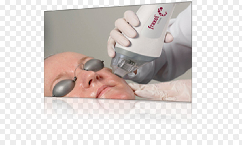 Fraxel Low-level Laser Therapy Facial Rejuvenation PNG
