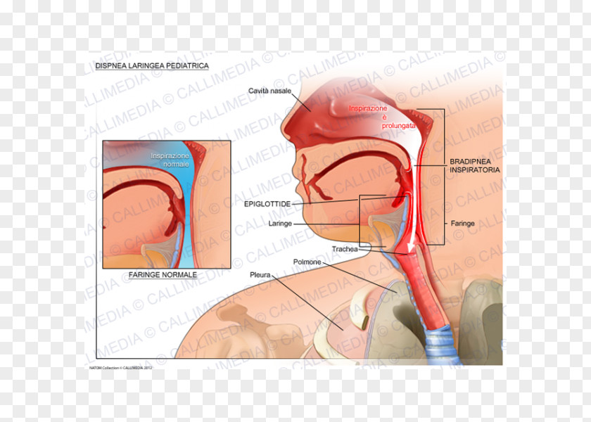 Ear The Nightmare Dyspnea Larynx Medicine PNG