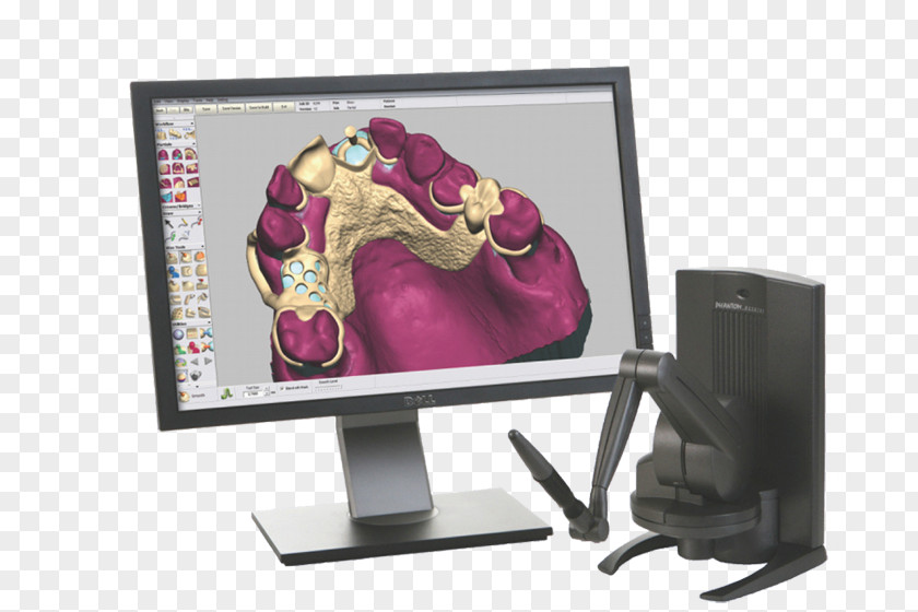 Design Computer Monitors Bilgisayarlı Tasarım/Bilgisayarlı üretim CAD/CAM Dentistry Computer-aided Dentures PNG