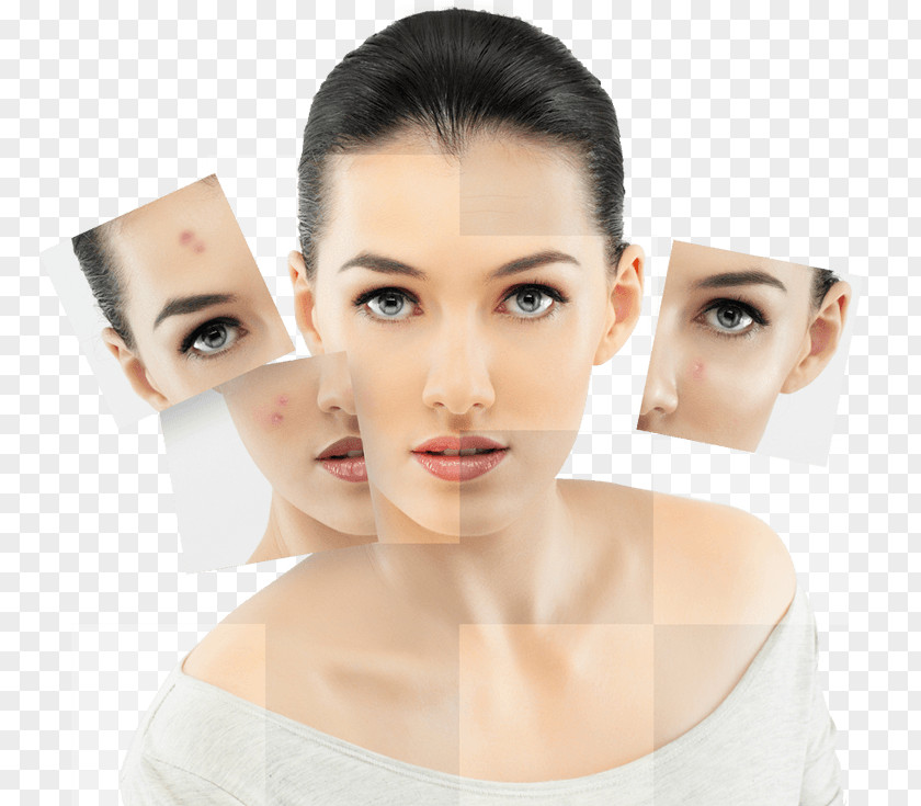 Beauty Salon Propaganda Skin Care Photorejuvenation Human Acne Collagen Induction Therapy PNG
