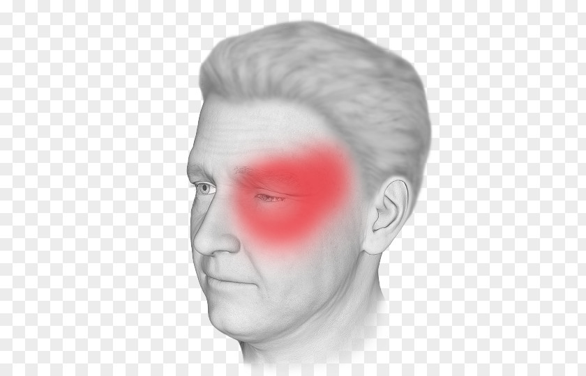 Back Pain Cluster Headache Disease Nose PNG