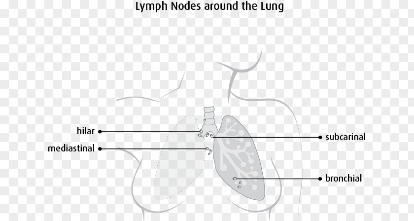 Cancer Cell Details Lymph Node The Lymphatic System Mediastinum Lung PNG