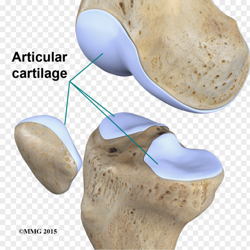 Articular Cartilage Damage Joint Repair Cartílago PNG