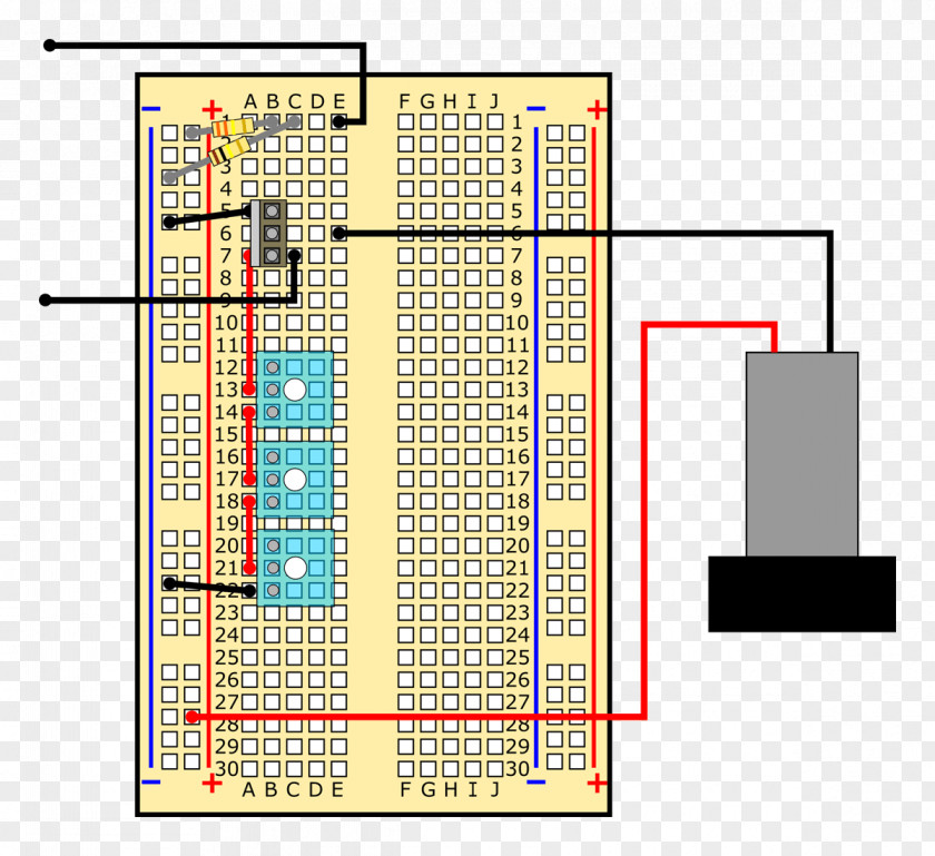 Artificial Pancreas Diabetes Mellitus Wiring Diagram Insulin Pump PNG