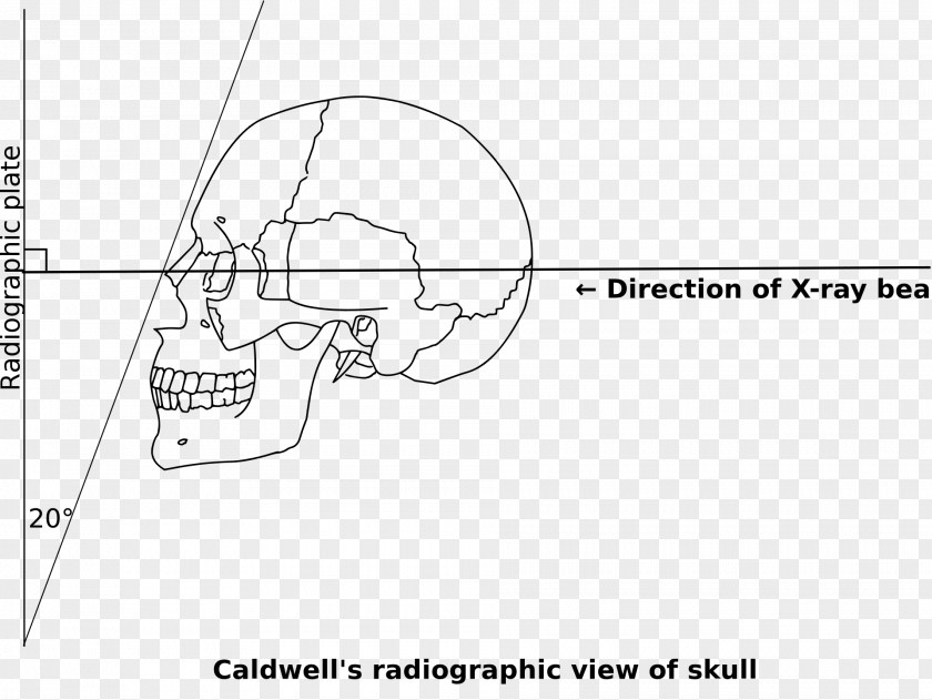 Acromegaly /m/02csf Ear Document Drawing PNG