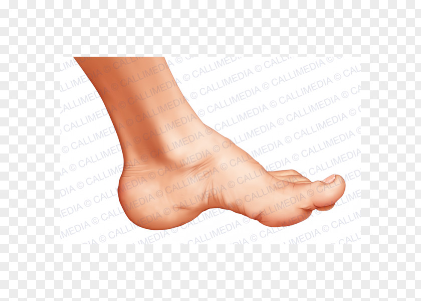 PIED Acromegaly Thumb Foot Endocrinology Pituitary Gland PNG