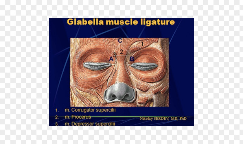 Nose Depressor Septi Nasi Muscle Glabella Músculo Mirtiforme PNG