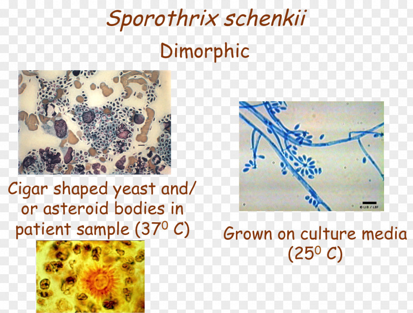 USMLE Step 3 Sporothrix Schenckii Organism PNG