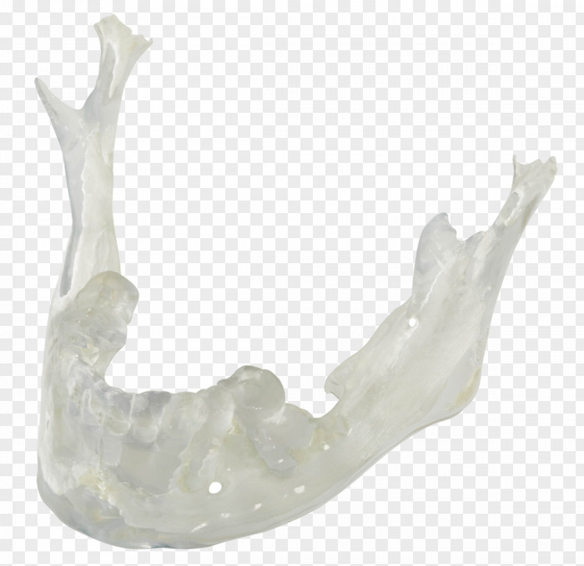 Dental Laboratory Crafters, Inc. 3D Printing Implant PNG