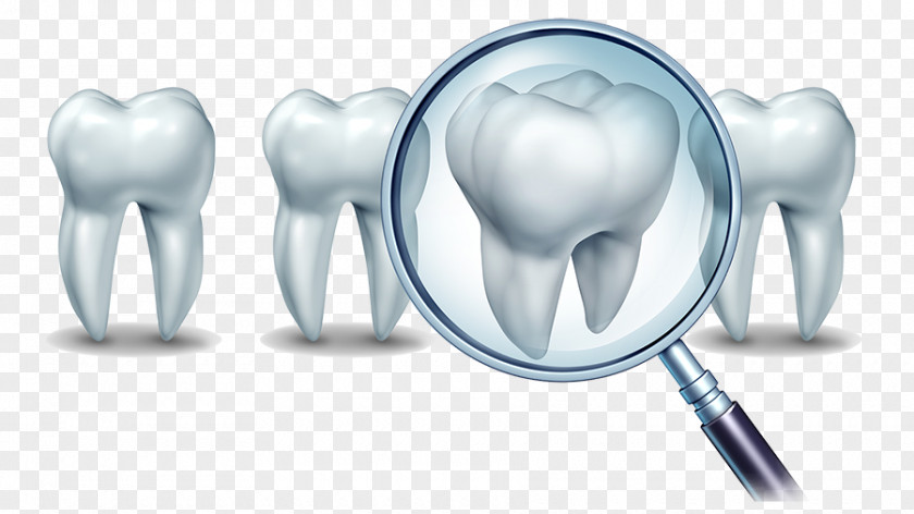 Implant Cosmetic Dentistry Dental Human Tooth PNG
