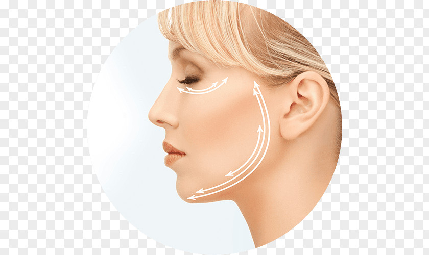 Face Rhytidectomy Surgical Suture Surgery Rejuvenation Therapy PNG