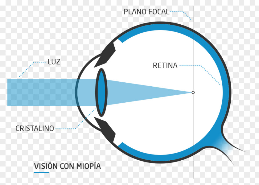 Eye Presbyopia Floater Far-sightedness Near-sightedness PNG