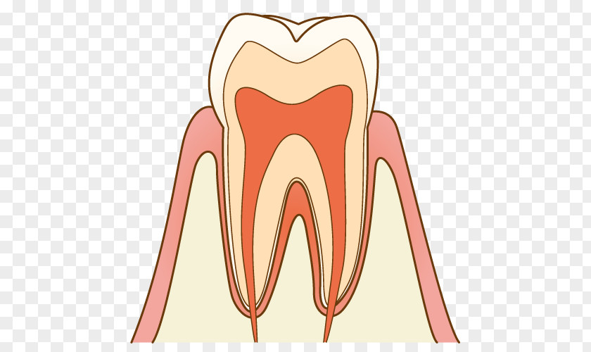 Tooth Cavity 歯科 Dentist Brushing Decay Therapy PNG